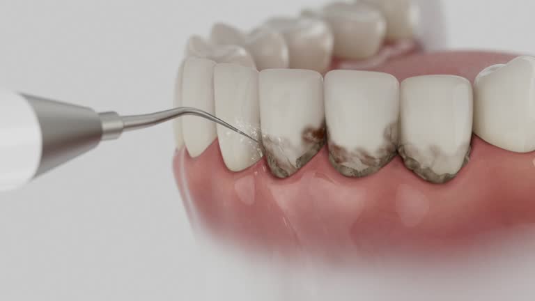 Reliable Dental Implants contractor in Hunter, TN by Smile Center Dentistry